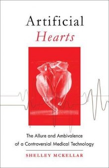 Artificial Hearts: The Allure and Ambivalence of a Controversial Medical Technology
