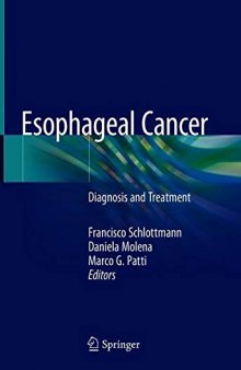Esophageal Cancer Diagnosis and Treatment