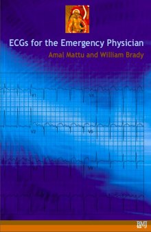 ECGs for the Emergency Physicians