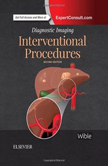 Interventional Procedures