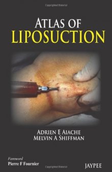 Atlas of Liposuction