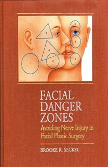 Facial Danger Zones: Avoiding Nerve Injury in Facial Plastic Surgery