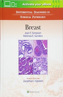 Differential Diagnoses in Surgical Pathology: Breast