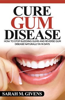 Gum Disease Cure (Gum Disease Cure, Periodontal Disease, Gum Disease, Gum Infection, Gingivitis treatment, Tooth Decay)