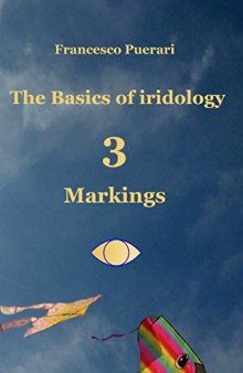 The Basics of Iridology 3 - Markings