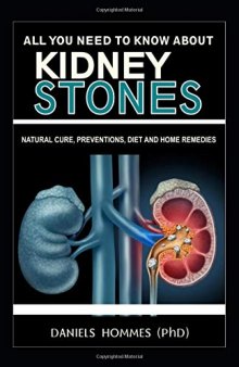 ALL YOU NEED TO KNOW ABOUT KIDNEY STONES: Natural Cure,Preventions,Diet and Home Remedies