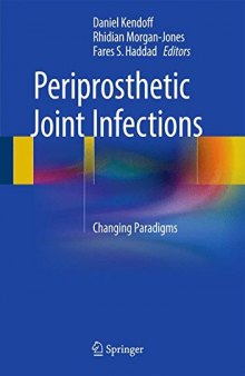 Periprosthetic Joint Infections: Changing Paradigms