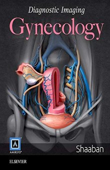 Diagnostic Imaging: Gynecology