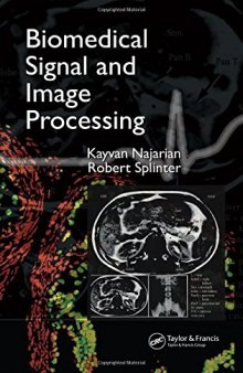 Biomedical signal and image processing