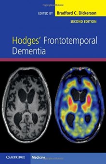 Hodges’ Frontotemporal Dementia