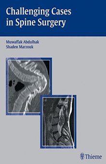 Challening Cases in Spine Surgery