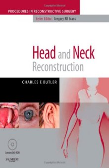 Head and Neck Reconstruction