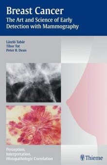 Breast cancer: the art and science of early detection with mammography: perception, interpretation, histopathologic correlation