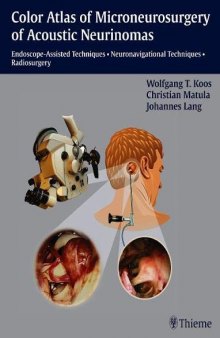 Color atlas of microneurosurgery of acoustic neurinomas: endoscope-assisted techniques, neuronavigational techniques, radiosurgery