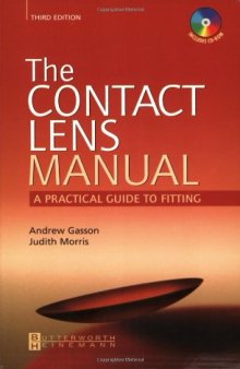 The Contact Lens Manual: A Practical Guide to Fitting