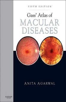 Gass’ Atlas of Macular Diseases