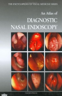 An Atlas of Diagnostic Nasal Endoscopy