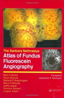 Atlas of Fundus Fluorescein Angiography