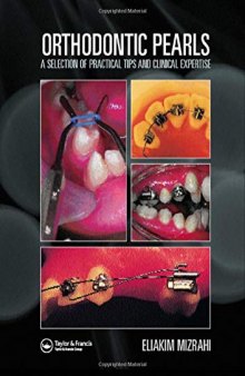 Orthodontic Pearls: A Selection of Practical Tips and Clinical Expertise