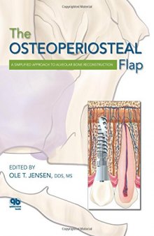 The Osteoperiosteal Flap: A Simplified Approach to Alveolar Bone Reconstruction