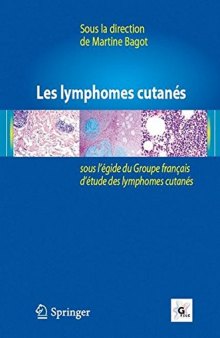 Les lymphomes cutanés: Sous l’égide du Groupe français d’étude des lymphomes cutanés