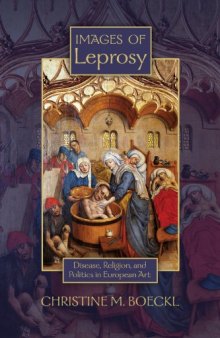 Images of Leprosy: Disease, Religion, and Politics in European Art