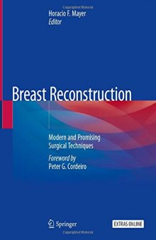 Breast Reconstruction: Modern and Promising Surgical Techniques