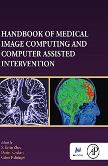 Handbook of Medical Image Computing and Computer Assisted Intervention (Elsevier and Miccal Society)