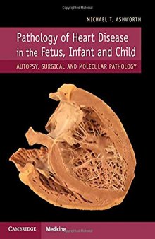 Pathology of Heart Disease in the Fetus, Infant and Child: Autopsy, Surgical and Molecular Pathology
