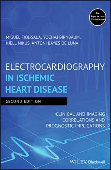 Electrocardiography in ischemic heart disease ; clinical and imaging correlations and prognostic implications