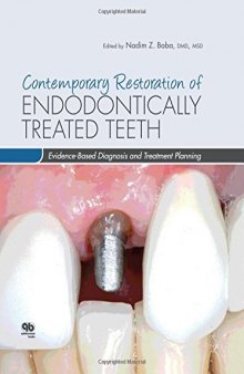 Contemporary Restoration of Endodontically Treated Teeth: Evidence-Based Diagnosis and Treatment Planning