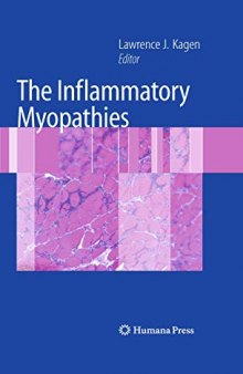 The Inflammatory Myopathies