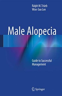 Male Alopecia: Guide to Successful Management