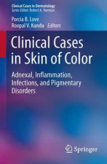 Clinical Cases in Skin of Color: Adnexal, Inflammation, Infections, and Pigmentary Disorders (Clinical Cases in Dermatology)