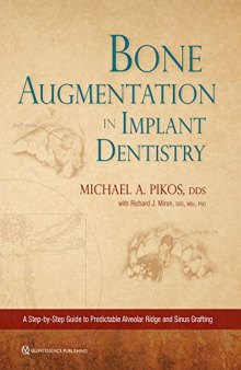 Bone Augmentation in Implant Dentistry: A Step-By-Step Guide to Predictable Alveolar Ridge and Sinus Grafting