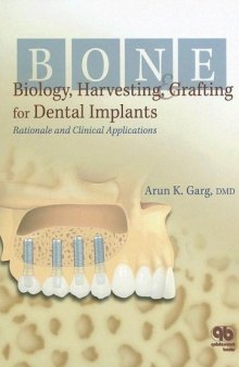 Bone Biology, Harvesting and Grafting for Dental Implants: Rationale and Clinical Applications