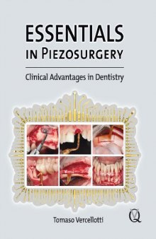 Essentials in Peiezosurgery: Clinical Advantages in Dentistry