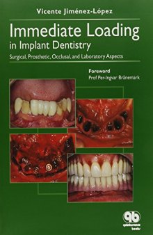 Immediate Loading in Implant Dentistry: Surgical, Prosthetic, Occlusal, and Laboratory Aspects