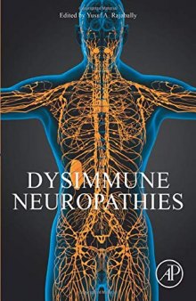 Dysimmune Neuropathies