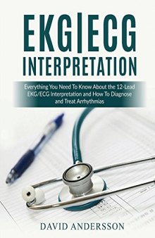 EKG/ECG Interpretation - Everything you Need to Know about the 12-Lead ECG/EKG Interpretation and How to Diagnose and Treat Arrhythmias