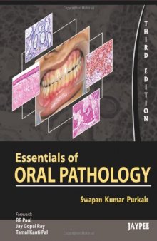 Essentials of oral pathology