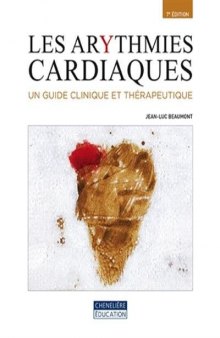 Les arythmies cardiaques : un guide clinique et thérapeutique