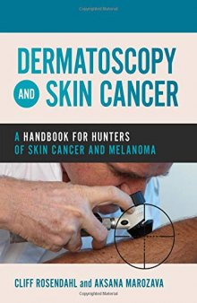 Dermatoscopy and Skin Cancer: A handbook for hunters of skin cancer and melanoma