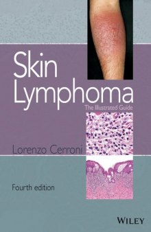 Skin Lymphoma: The Illustrated Guide