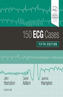 150 ECG Cases [CONVERTED PDF]