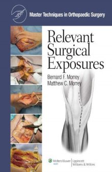 Master Techniques in Orthopaedic Surgery Relevant Surgical Exposures 2nd Edition