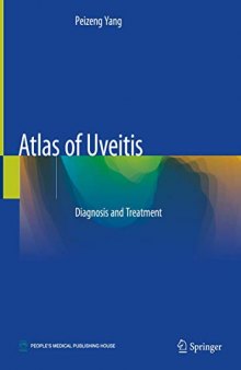 Atlas of Uveitis: Diagnosis and Treatment