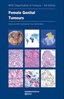 WHO classification of female genital tumours: WHO Classification of Tumours (World Health Organization Classification of Tumours)