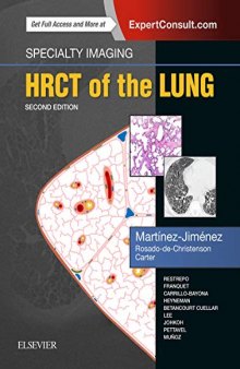 Specialty Imaging: HRCT of the Lung
