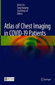 Atlas of Chest Imaging in COVID-19 Patients